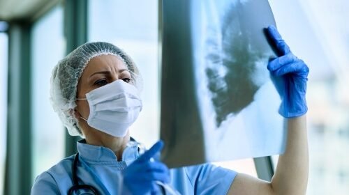 Female medical professional examining a chest X-ray to assess potential Lung Disease in a clinical setting.