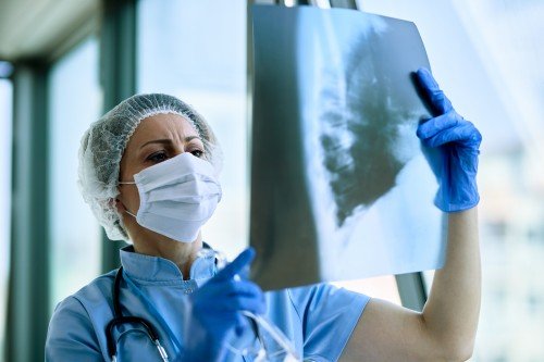 Female medical professional examining a chest X-ray to assess potential Lung Disease in a clinical setting.