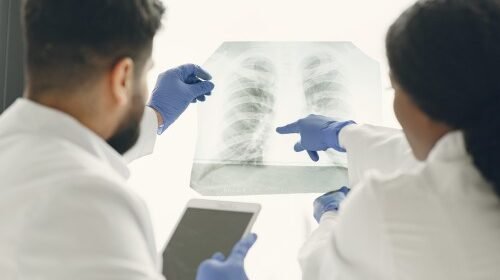 Two doctors examining a chest X-ray to assess lung health and discuss potential signs of Lung Cancer