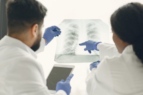 Two doctors examining a chest X-ray to assess lung health and discuss potential signs of Lung Cancer